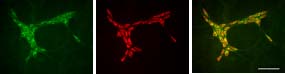 Immunoreactivity for MAb35 and Hu in submucosal plexus in the guinea-pig distal colon